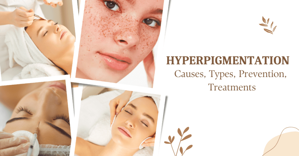 A Comprehensive Guide To Hyperpigmentation Causes, Types, Prevention ...